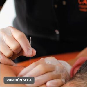 Calmar punción seca